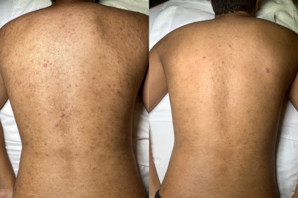 Mindykim Skincare